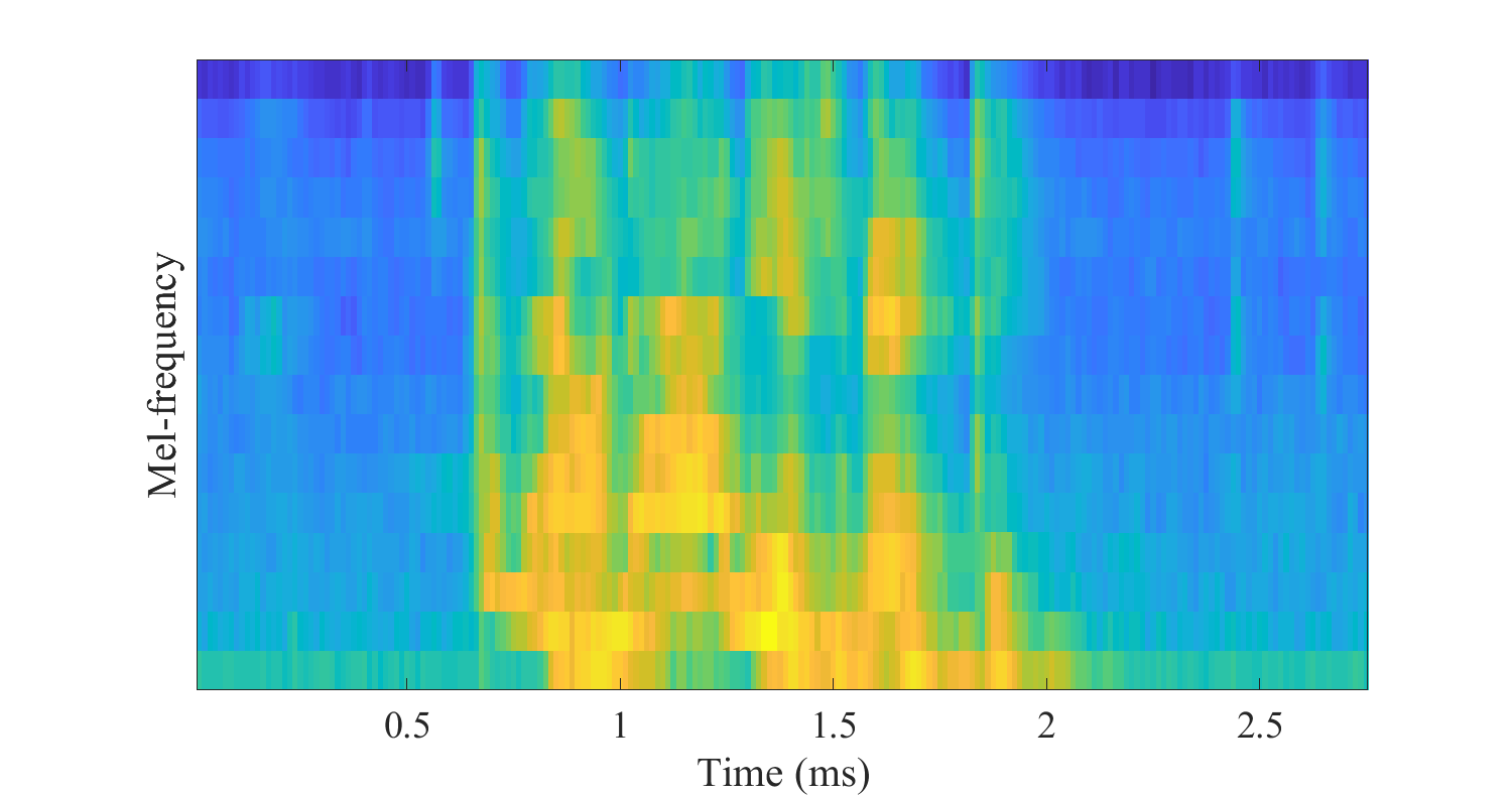 melspectrogram